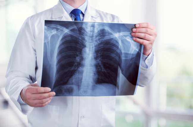 Patient-centered Radiation Safety