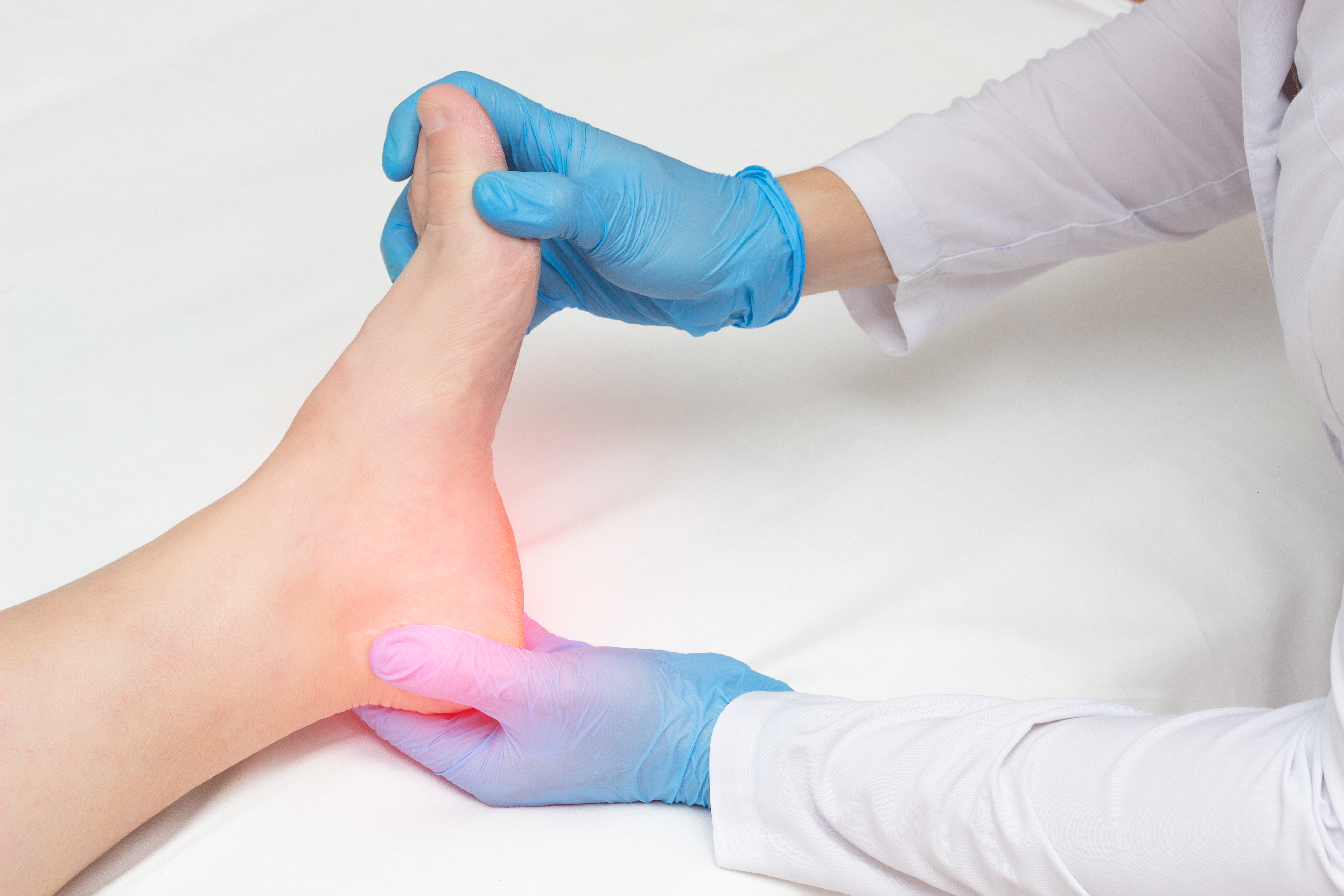 Bone spurs