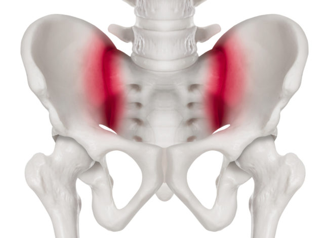 Sacroiliac Joint Pain, an Under-Recognized Cause of Back Pain