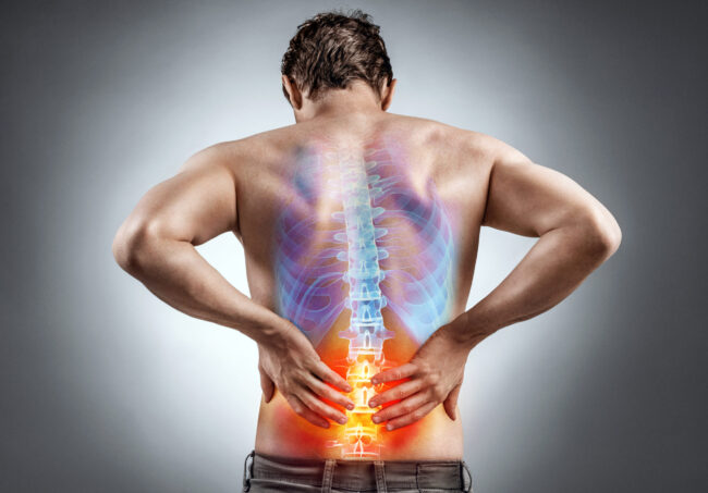 How to Tell If Your Spine Is Misaligned, and What to Do About It How to Tell If Your Spine Is Misaligned, and What to Do About It