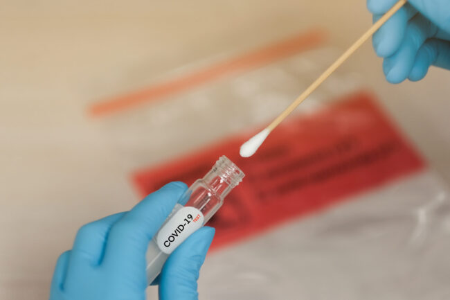 Covid-19,Nasal,Swab,Laboratory,Test,In,Hospital,Lab Prairie COVID-19 Testing Updates
