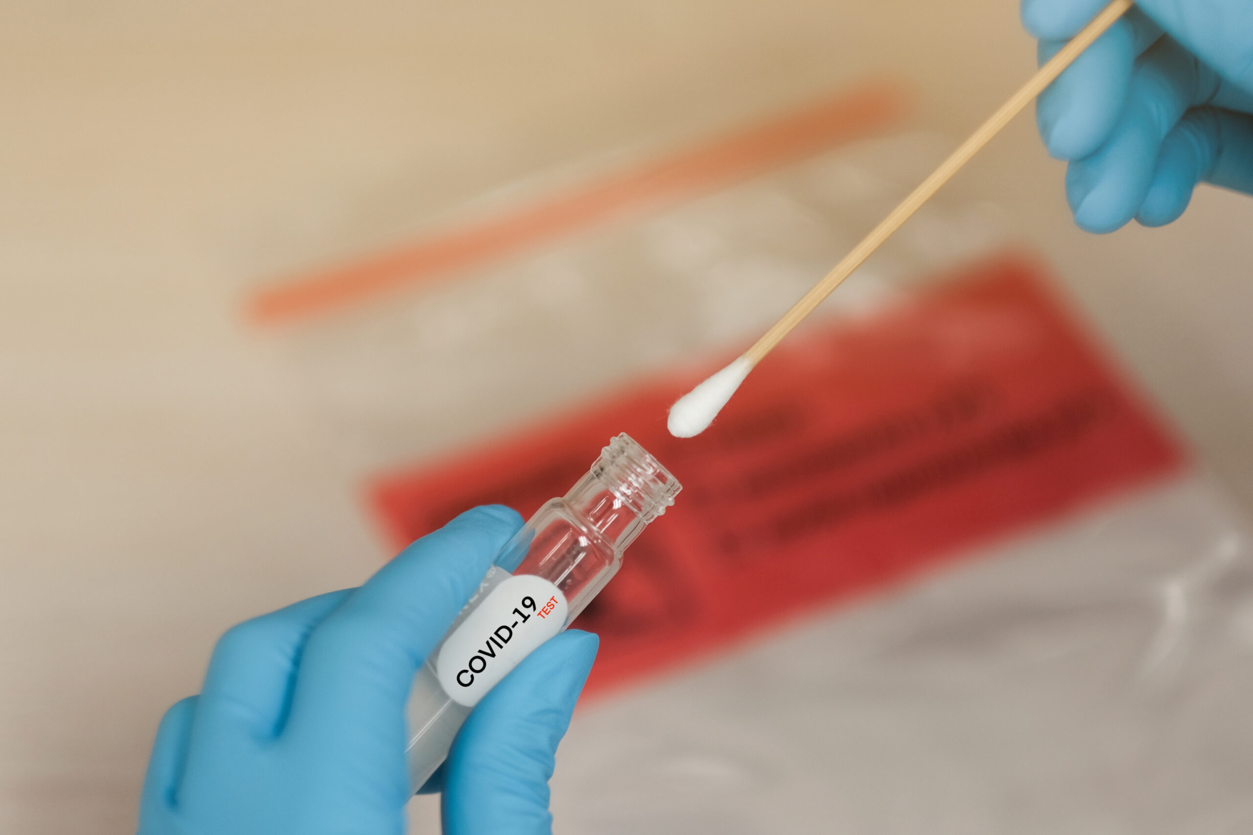 Covid-19,Nasal,Swab,Laboratory,Test,In,Hospital,Lab Prairie COVID-19 Testing Updates