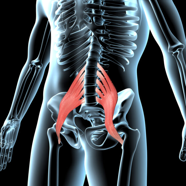 Your Psoas Muscle Is Key to Fighting Back Pain