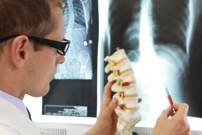 Lumbar Total Disc Replacement vs Fusion: Which to Choose