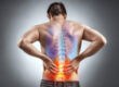 Symptoms of a Spinal Compression Fracture