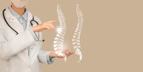 What is spondylosis?