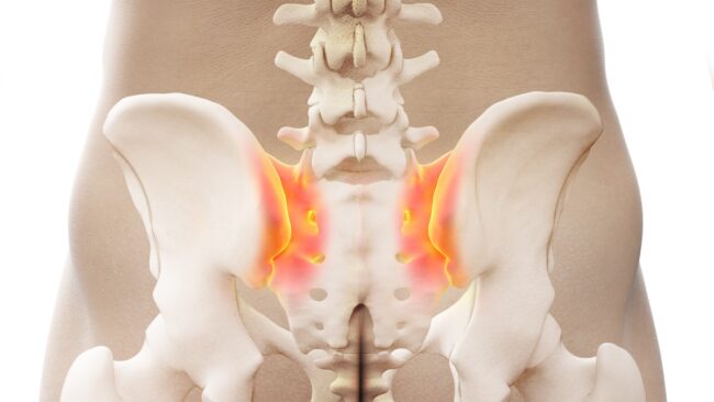 Sacroiliac Joint Problems: Understanding SIJ Dysfunction, Symptoms, and Treatment Options