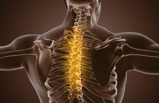 Achieving Optimal Spine Health in 2025