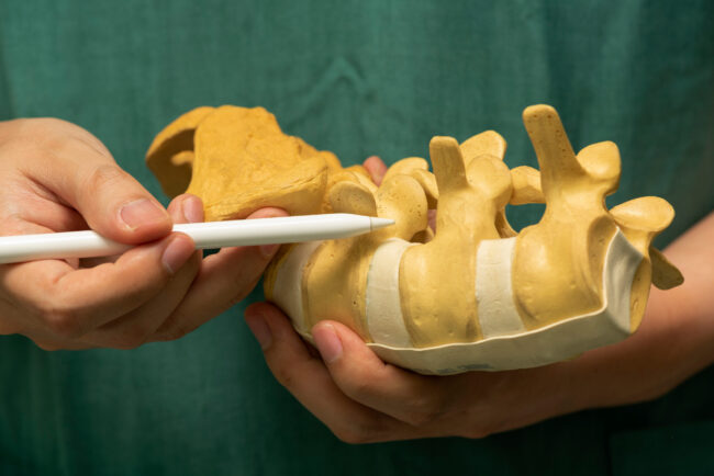 Understanding Lumbar Corpectomy Treatment Options