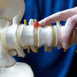 Understanding Minimally Invasive Procedures Understanding Minimally Invasive Procedures