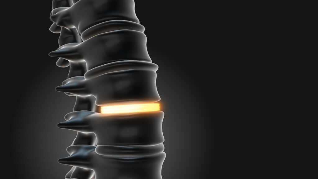 Because Motion Matters: Spine Treatments That Preserve Flexibility