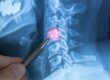 The Science of Spinal Disc Health and Care