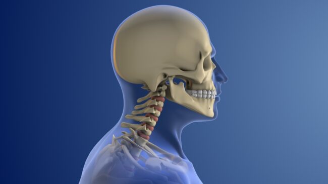 10 Expert Tips to Prevent Neck and Spine Problems 10 Expert Tips to Prevent Neck and Spine Problems